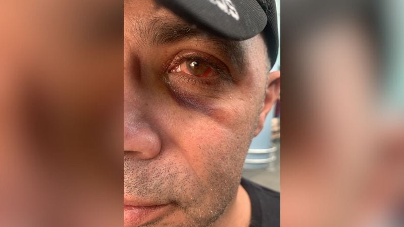 "אנחנו מרגישים מופקרים": פקח המטרונית העיר לנוסעים על עישון והותקף